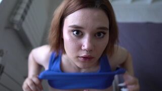 A girl with a broken face from excessive saliva